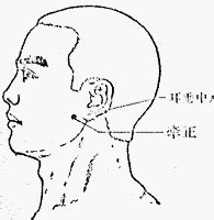 牽正穴|醫砭 » 經穴庫 » 牽正